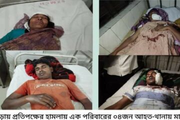 বগুড়ায় প্রতিপক্ষের হামলায় এক পরিবারে আহত ৪, থানায় মামলা