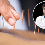 আকুপাংচার চীনের প্রাচীন চিকিৎসা